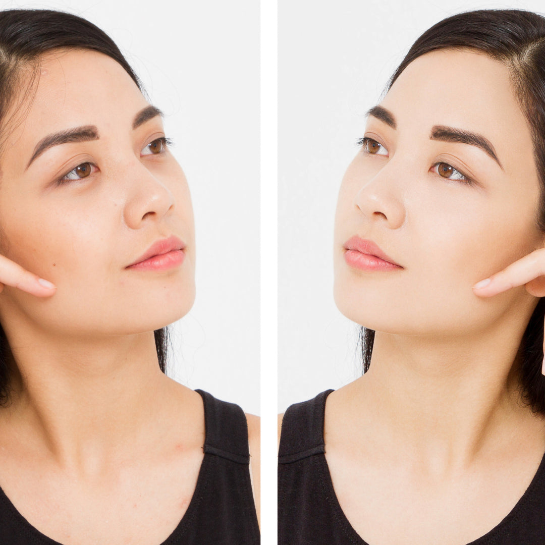 How To Deal With Dark Circles Under Your Eyes
