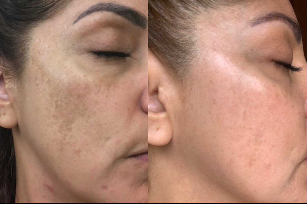 Dark Spot Correcting Serum