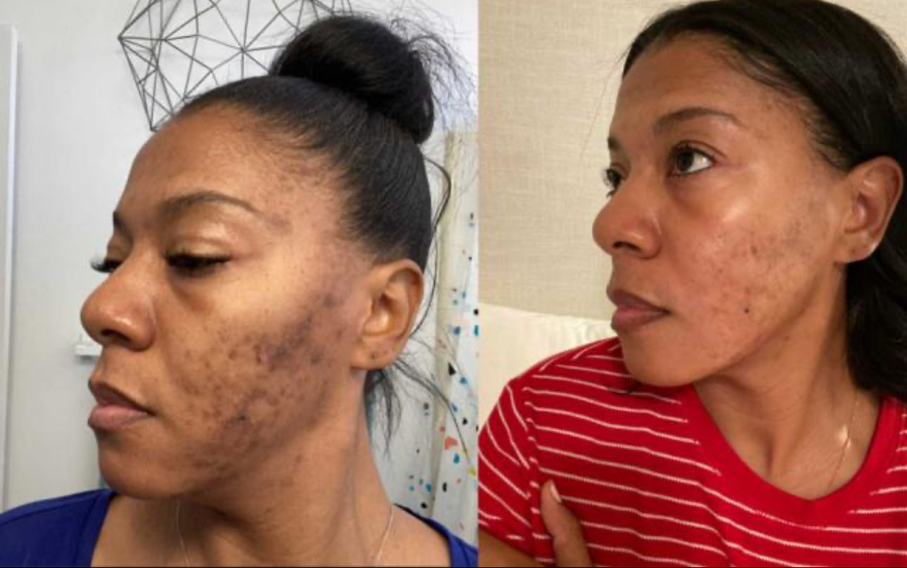 Dark Spot Correcting Serum