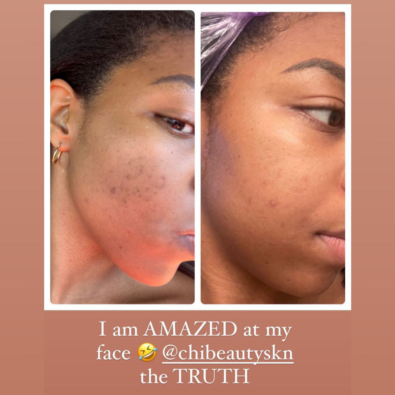 Dark Spot Correcting Serum